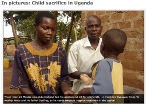 Ugandan child mutilated by witch doctors